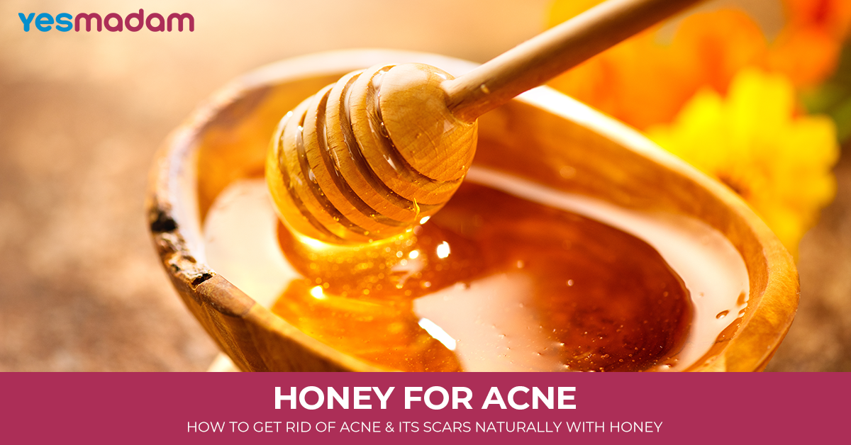 Honey for Acne: How to Get Rid of Acne and its Scars Naturally with Honey