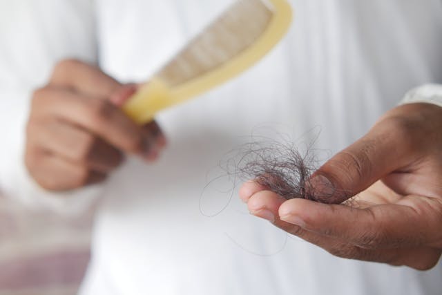 What Can You Do About Thinning Hair? Start Here