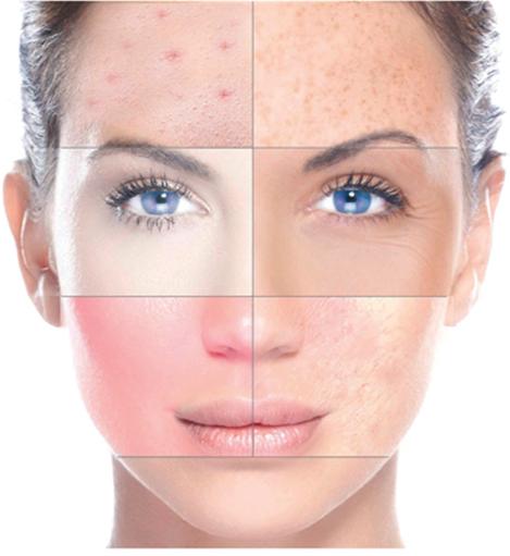 Are You Happy With The Skin You’re in?