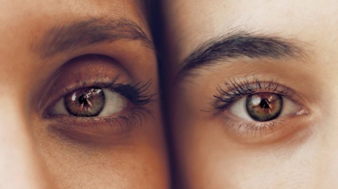 When Eyelid Surgery Is More Than A Matter Of Appearance